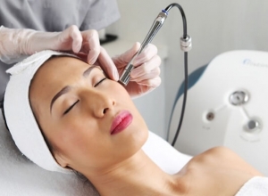 {Xem Ngay} Trị tàn nhang bằng tia laser có tốt không?